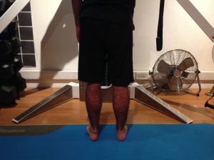 Self-Mobilization: Heel Slide (Supine)