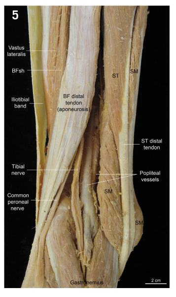 back of the knee dissected